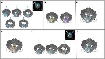 Sample strategies for the assessment of the apparent diffusion coefficient in single large intracranial space-occupying lesions of dogs and cats